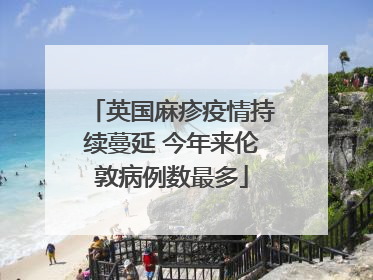 英国麻疹疫情持续蔓延 今年来伦敦病例数最多